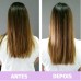 Biotin Hair - Cabelo, Pele E Unha - 5 potes 